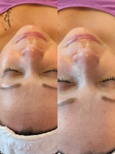 kolagenové nitě (2).jpg