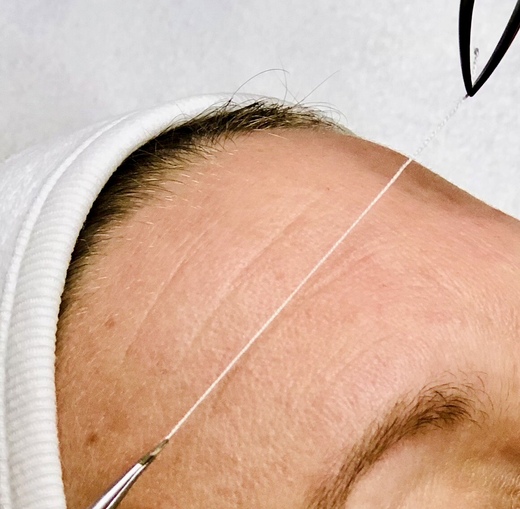 kolagenové nitě (3).jpg