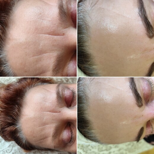 kolgenové nitě (2).jpg