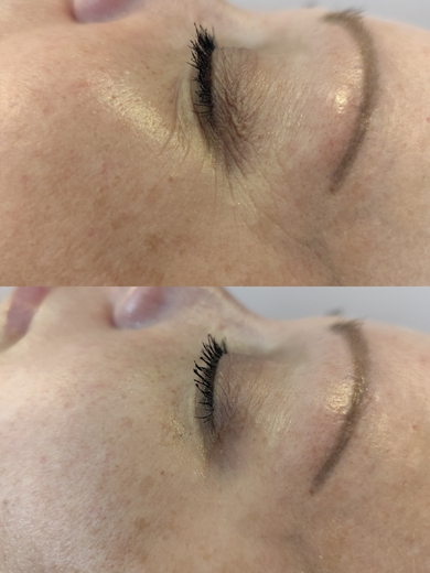 kolgenové nitě.jpg